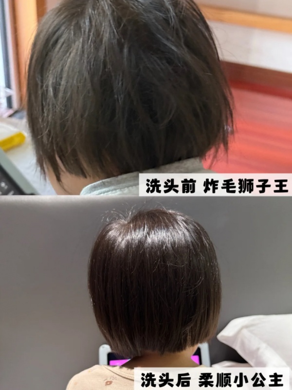 夏季儿童“油头痒痒”如何科学应对？草本洗发水选购参考